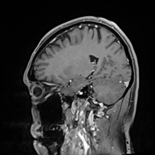 Click on the Serie image to view the images of VILLANUEVA, WILLIAM A.